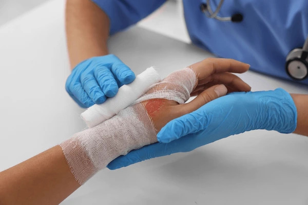 Burn Injury Care