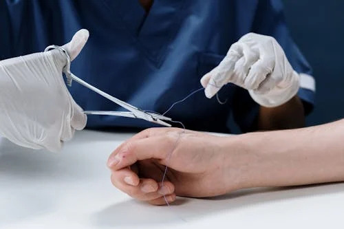 Sutures and Wound Closure