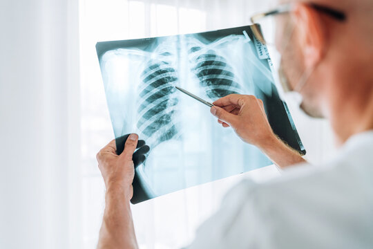 X-Rays and injury treatment
